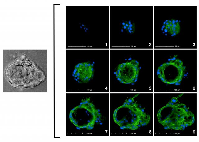 3D thyroid microtissue