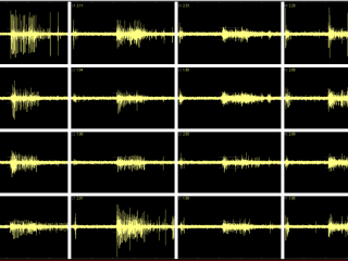 A snapshot of electrical activity in one well of the "brain on a chip."