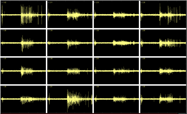 A snapshot of electrical activity in the "brain on a chip."